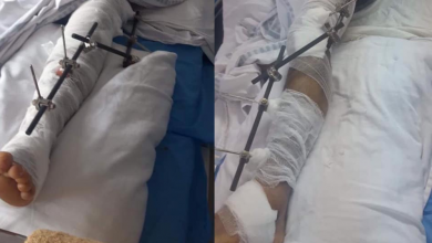 Photo of Vrea să se întoarcă acasă pe picioarele lui. Un moldovean, rănit grav într-un accident în România, are nevoie de ajutorul nostru