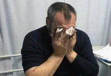 Photo of foto, video | Mai mulți susținători ai lui Petic, ajunși la spital. Ce spune poliția despre intervenția cu gaze lacrimogene?