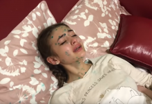 Photo of video | Varicela i-a dat mari bătăi de cap. Iuliana Beregoi a filmat un vlog despre cum a depășit boala