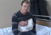 Photo of foto | Un bărbat din Dubăsari, internat în spital, după ce ar fi fost atacat cu bestialitate de trei femei
