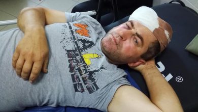 Photo of foto | Un candidat la funcția de consilier în Căușeni, bătut cu cruzime. Poliția oferă detalii despre agresor și motivul conflictului
