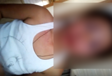 Photo of video | O fetiță din Călărași, aflată în plasament temporar, maltratată: Reacția Alei Nemerenco