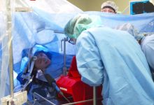 Photo of video | O operaţie pe creier a fost transmisă în direct pe Facebook. Cum a reacționat pacienta, fiind conștientă în tot acest timp?
