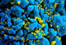 Photo of A fost descoperit un nou tip al virusului HIV. Ce spun specialiștii despre acesta?
