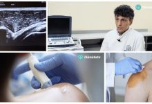 Photo of video | iSănătate #7: Ultrasonografia articulațiilor. Cum identificăm și tratăm problemele ligamentelor?