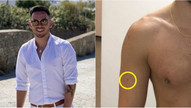 Photo of foto | Un bărbat a descoperit că suferă de cancer la piele datorită… unei aplicații din telefon. „Sunt norocos că gadgetul mi-a dat de știre la timp”