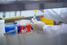 Photo of Moldova ar putea cumpăra încă 1000 de teste pentru depistarea coronavirusului