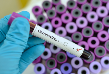 Photo of foto | Primele teste pentru depistarea coronavirusului de tip nou au ajuns în Republica Moldova