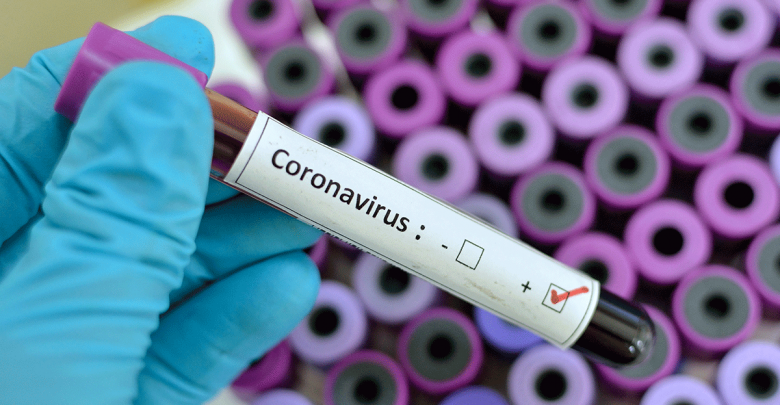 Photo of ultima oră | 17 cazuri noi de infecție cu coronavirus. Numărul total a ajuns la 66