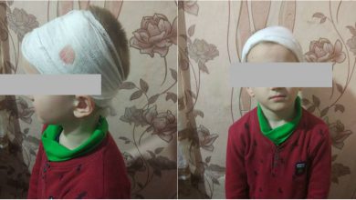 Photo of foto | Însângerat și cu o rană adâncă în regiunea scalpului – astfel și-a luat o mamă copilul seara de la grădiniță. Care este reacția educatoarei?