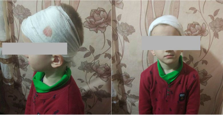 Photo of foto | Însângerat și cu o rană adâncă în regiunea scalpului – astfel și-a luat o mamă copilul seara de la grădiniță. Care este reacția educatoarei?