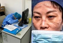 Photo of foto | Cu răni pe față de la măștile de protecție și adormind pe scaune. Cum arată medicii chinezi care tratează pacienții cu coronavirus?