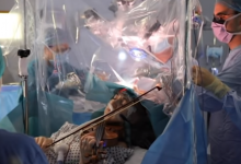 Photo of video | Le-a cântat medicilor la vioară în timpul unei operații pe creier. Povestea incredibilă a unei violoniste
