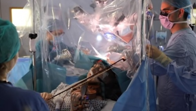 Photo of video | Le-a cântat medicilor la vioară în timpul unei operații pe creier. Povestea incredibilă a unei violoniste