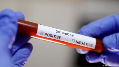 Photo of ultima oră | Astăzi s-au confirmat 148 de cazuri de coronavirus. Numărul total al bolnavilor a ajuns la 2926