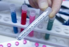 Photo of ultima oră | Coronavirus în Moldova: 29 de persoane infectate. Au fost anunțate alte șase cazuri