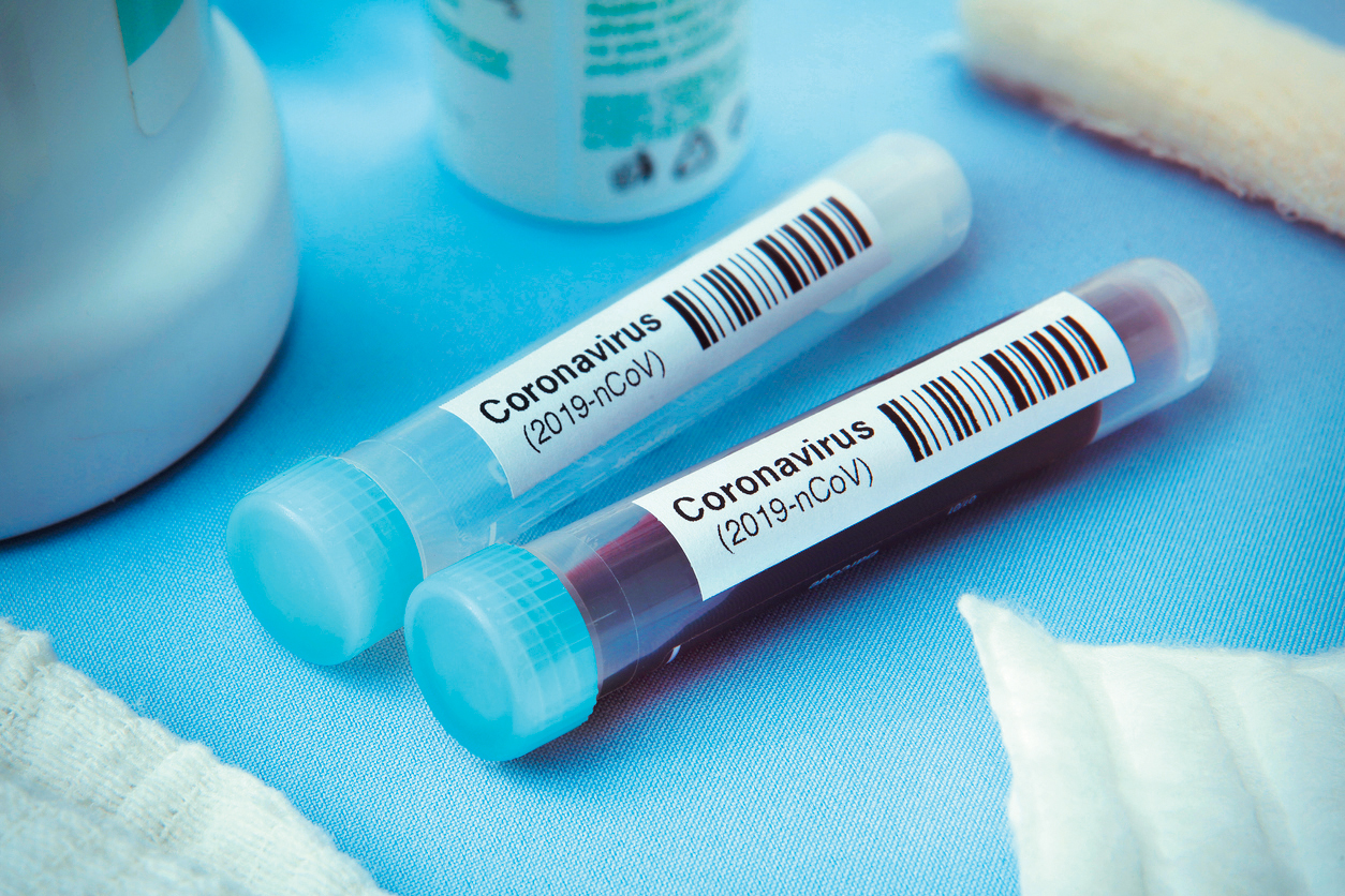 test covid coronavirus