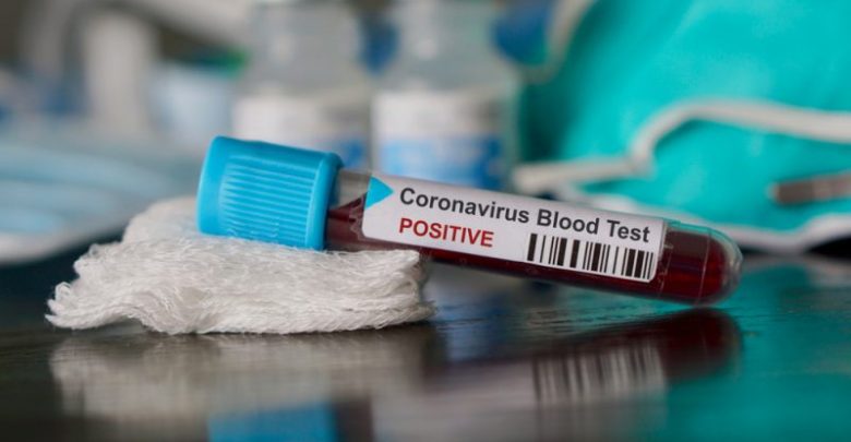covid coronavirus test