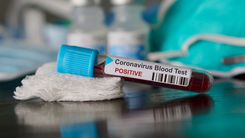 covid coronavirus test