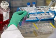 Photo of ultima oră | Avem 151 de cazuri noi de coronavirus. Care este numărul de probe procesate?