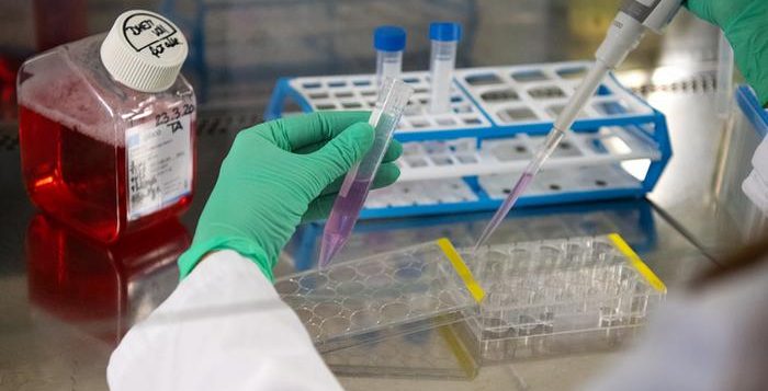 Photo of ultima oră | Avem 151 de cazuri noi de coronavirus. Care este numărul de probe procesate?