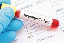 Photo of Acum puteți face testarea rapidă la hepatitele virale B și C. Iată ce trebuie să știți