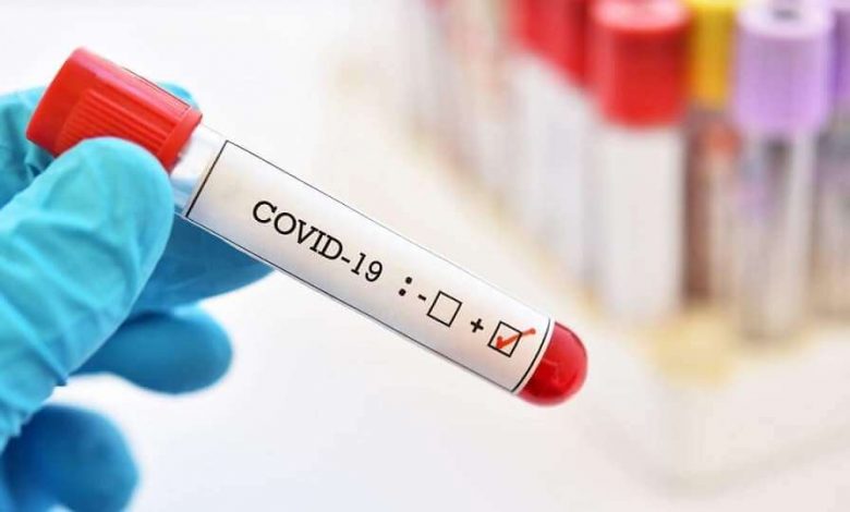 Photo of Tendințe alarmante. În Chișinău, aproape fiecare a doua persoană testată este diagnosticată cu COVID-19