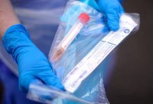 Photo of „Situația este sub control”: Autoritățile dau asigurări că R. Moldova dispune de teste suficiente pentru depistarea coronavirusului
