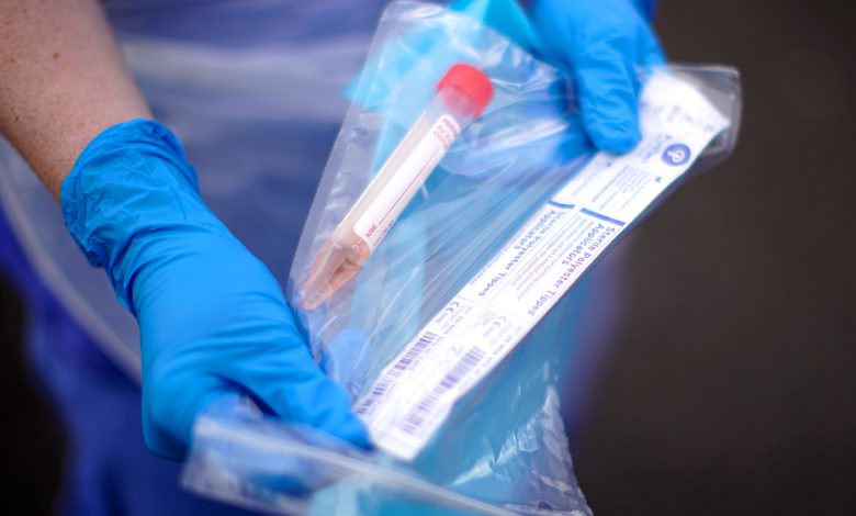 Photo of „Situația este sub control”: Autoritățile dau asigurări că R. Moldova dispune de teste suficiente pentru depistarea coronavirusului