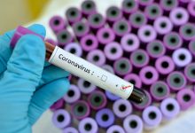 Photo of Coronavirus: 30 de oameni, răpuși de infecție, iar alții 1636 – testați pozitiv