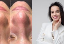 Photo of Problemele pe care le întâmpinăm dacă nu acordăm atenție tenului: Cosmetologul Lia Inculeț explică pașii pentru îngrijirea corectă a feței