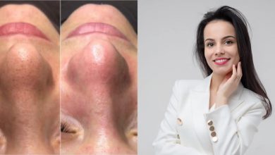 Photo of Problemele pe care le întâmpinăm dacă nu acordăm atenție tenului: Cosmetologul Lia Inculeț explică pașii pentru îngrijirea corectă a feței