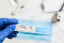 Photo of Instituțiile medicale din țară au primit teste rapide pentru detectarea COVID-19