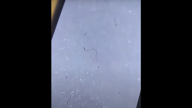 Photo of video | Mitul „viermilor” din măştile de protecţie, demontat de fizicianul Cristian Presură. Ce sunt, de fapt, obiectele care apar la microscop