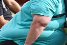 Photo of OMS avertizează: Pandemia de COVID-19 ar putea crește obezitatea în rândul copiilor