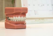 Photo of Ortodonția – calea spre un zâmbet sănătos și o dantură perfectă