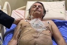 Photo of Brazilia: Președintele ar putea fi operat de urgență în urma sughițurilor pe care le are de 10 zile