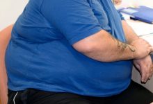 Photo of studiu | Planta din America de Sud care ar putea atenua efectele dăunătoare ale obezităţii