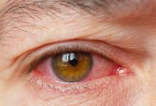 Photo of studiu | Cum ameliorăm disconfortul din cauza ochilor uscați? Afectează unul din trei oameni în lume