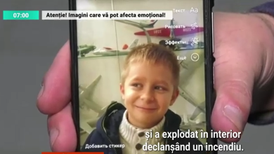 Photo of video | Harkiv: Copiii răniți de schije și gloanțe sunt operați în timp ce orașul este bombardat