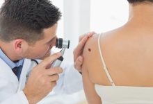 Photo of Screening gratuit pentru depistarea cancerului de piele. Unde se face în Chișinău