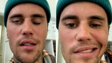 Photo of Cât de gravă este paralizia facială de care suferă Justin Bieber. Noi detalii