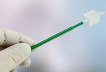 Photo of Serviciul de screening cervical din R. Moldova va fi digitalizat. Guvernul a aprobat hotărârea