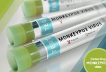 Photo of OMS face apel la „acţiune urgentă” împotriva variolei maimuţei în Europa