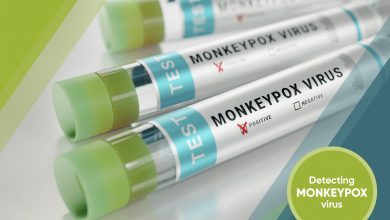 Photo of Ce trebuie să știi despre variola maimuței? Precizările experților