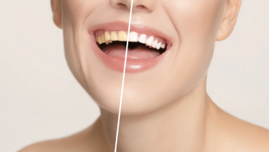 Photo of Cauzele din care dinții se pot îngălbeni mai repede decât credem. Ce trebuie să evităm