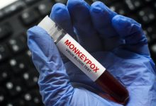 Photo of Un bărbat s-a infectat în același timp cu variola maimuței, COVID-19 și HIV