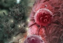Photo of O femeie a supraviețuit la 12 tumori, cinci fiind maligne. Excepționala sa poveste deschide noi căi pentru vindecarea cancerului