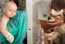 Photo of La doar zece luni a fost diagnosticat cu retinoblastom. Un bebeluș necesită ajutor pentru a continua tratamentul