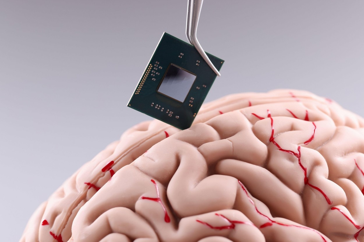 Photo of S-a dat aprobarea pentru a implanta cipuri în creierele oamenilor: Firma unui miliardar a primit undă verde